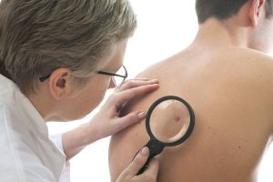 COLLABORAZIONE INTERNAZIONALE PER L’AMBULATORIO DI DERMATOLOGIA ONCOLOGICA